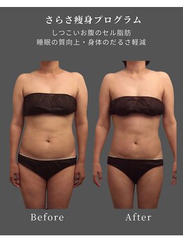 ナチュラル ビューティー スタイル さらさ(Natural Beauty Style)/モニターコース続々結果出し◎