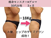 ファニービー 高槻店/症例写真