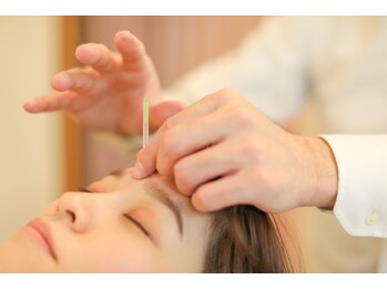 サンソ 三田店(sanso)の写真/ヘッドスパと組み合わせた小顔リフトアップ美容鍼が人気◎熟練スタッフによる施術で他店との違いを実感☆