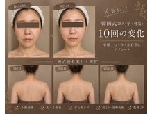 アグレーブル(Agreable)の雰囲気（お顔だけじゃない。身体もすっきり、姿勢改善＆慢性こりをケア◎）