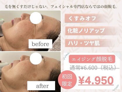 パーム(Palm)の写真