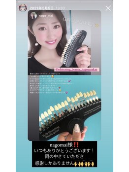 ホワイトニングビューティー 名古屋栄店(WHITENING BEAUTY)/セルフホワイトニング