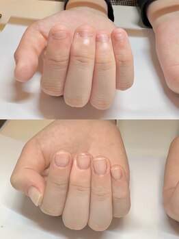 マリーロール 梅田店(Marie Laure)/自爪育成/深爪矯正/ネイルケア