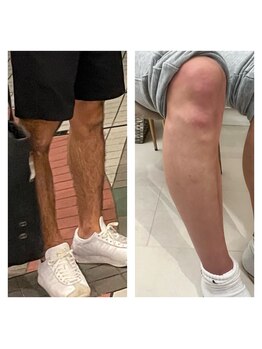 ヴィヴ コレビ(VIV COREBI)/男子も美肌