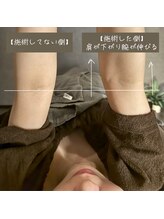 首の休日/【施術事例】