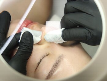 エステティックサロン グリーンアイ 浦和店(green.i)の写真/毛穴汚れをごっそり洗浄&キュッと引き締め★ララピール×毛穴洗浄×アクアダーマ(ヘッド付)110分15000円