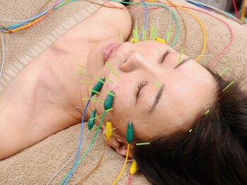 ベルシャ(Belle Chat)の写真/美容鍼/未経験者でもご安心を!頭痛から眼精疲労も改善!翌朝のお化粧のノリ/ハリ感UPしたとリピート様続出♪