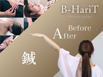 ビーハリット(B-HariT)/【メニュー紹介】鍼