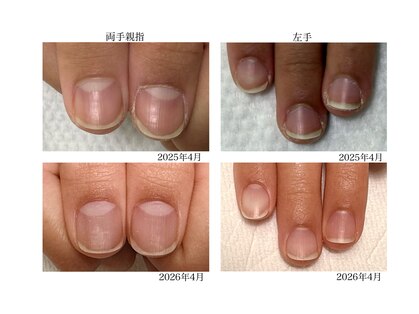 トイロ ネイル(Toiro Nail)の写真