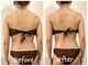 ルーシーガーデン(LUCY GARDEN)の写真/当店人気メニュー◎希少【インディバ×おかま直伝よもぎ蒸し】W温活燃焼系 痩身&疲れ等、首肩こり睡眠！