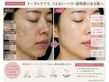 ルナ クレッシェンテ(Luna crescente)/肌悩みはトータルケアで即実感