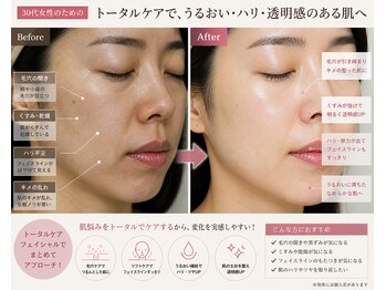 ルナ クレッシェンテ(Luna crescente)/肌悩みはトータルケアで即実感