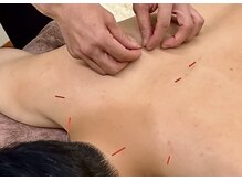 きえ鍼灸整骨院の雰囲気（肩こり悩みに◎深部にアプローチ！）
