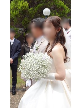 ノア(NOA)の写真/ブライダル小顔矯正と美容鍼で理想のラインへ。自信が持てる小顔を目指そう♪