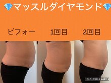 ボディエイジングラボ マハロ(MAHALO)/寝たまま楽々シェイプ！EMSの8倍