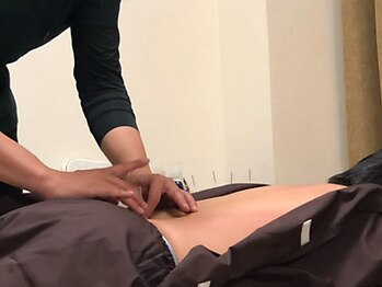 ケヤキ(KEYAKI)の写真/身体の不調,自律神経,不眠,頭皮ケア等様々なお悩みに対応した鍼灸施術。小顔になりたい方は電気美容鍼も◎