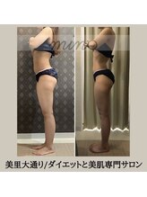 ミノ 美里大通り店(mino)/ダイエットパッケージ