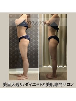 ミノ 美里大通り店(mino)/ダイエットパッケージ