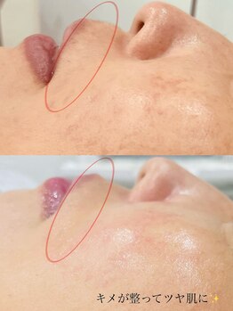 プチ プロムナード(Petit Promenade)/美肌フェイスワックス