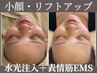 小顔人気No.2☆Wリフトアップ!ノンニードル水光注入＋頭皮&表情筋EMS¥6050