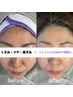 美肌フェイシャルワックス(保湿パック付)/¥9900
