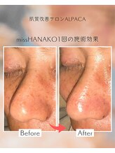 アルパカ(ALPACA)/missHANAKO