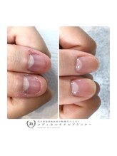 トイロネイル(toironail)/お爪のお悩みご相談ください！