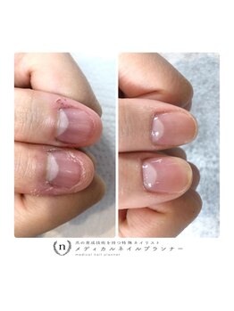 トイロネイル(toironail)/お爪のお悩みご相談ください！