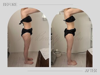 リー(Riy)/《Before and After》20代