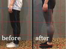 ヴレ 福岡店(Vraie)/ピラティスで太もも張りを解消！