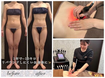 メディカルエステサロン ローズ 鯖江店(ROSE)の写真