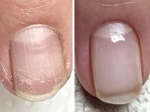 カランコエ(Kalanchoe)/地爪育成