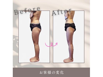 ヨサパーク ハーブチャーム(YOSAPARK herb charm)の写真