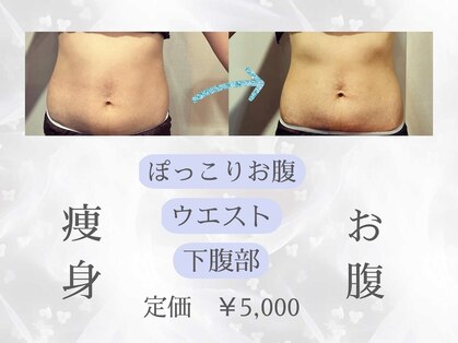 ムーンライトビューティーの写真