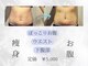 ムーンライトビューティーの写真