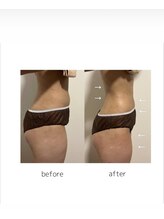 マルレ 三軒茶屋(MARLE)/体型の変化も