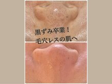 ウェリナポノビューティサロン(welina pono beauty salon)/《小顔/毛穴/脱毛》