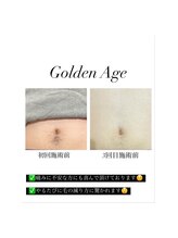 ゴールデンエイジ(Golden Age)/【ヒゲ脱毛】Before＆After