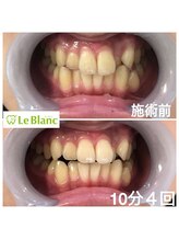 ルブラン 奈良店(Le Blanc)/イベント前に欠かせない！