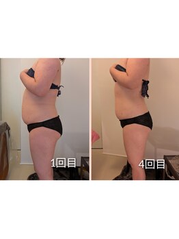 ワイズ(Y's)/お腹４回目