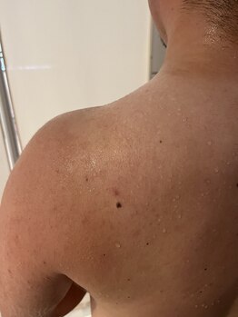 ココネ(cocone)/滝汗(ハーブ)