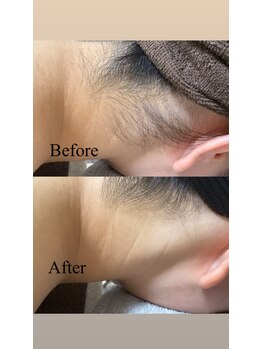 ルアーナ(LUANA)/