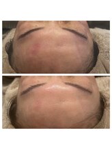 美温(mion)/艶々＆うるうる満たし肌