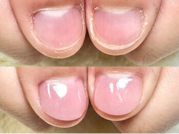 グラシナ 鳥丸店/(深爪/長さだし/フィルイン/)