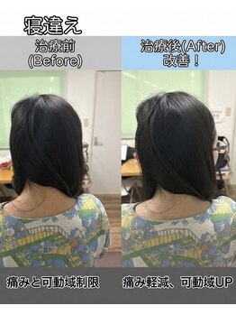 ただのばんそう整体院 吉祥寺/首の可動域改善