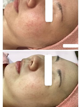 ロゼブランシュ(Rose Blanche)/