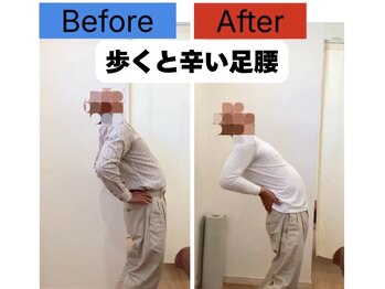 クレストかごしま ウェルネスストレッチ(Wellness Stretch)/5分も歩けませんでした