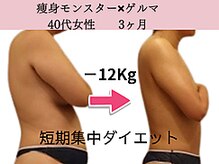 ファニービー 高槻店/症例写真