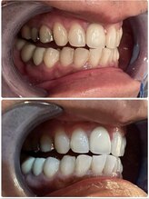 【医療提携】ホワイトニング専門店～Cinderella～/