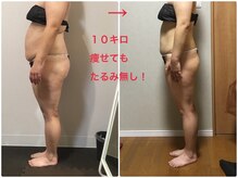 オージャス(OJAS)/40代○○様の変化　痩ボディーへ